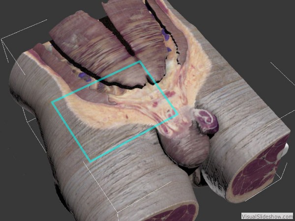 Figure 2— A cryomacrotome dataset is composed of a sequence of high-resolution color slices through the human body. Anatomical models from the inguinal region (blue square) are isolated from this data.